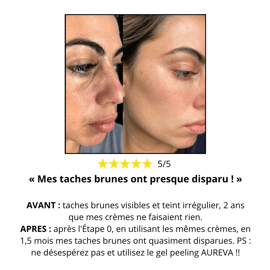 Gel Peeling « Étape 0 » – Indispensable pour que vos soins fonctionnent