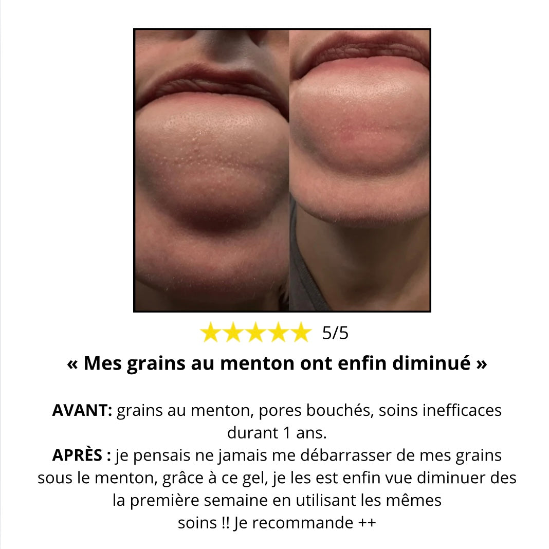 Gel Peeling « Étape 0 » – Indispensable pour que vos soins fonctionnent