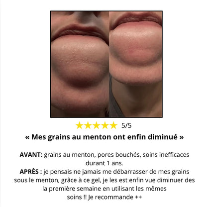 Gel Peeling « Étape 0 » – Indispensable pour que vos soins fonctionnent